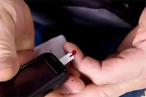 图片细节说明